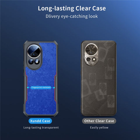 XUNDD For Huawei nova 12 5G Case Airbag Protective TPU+Acrylic Phone Cover